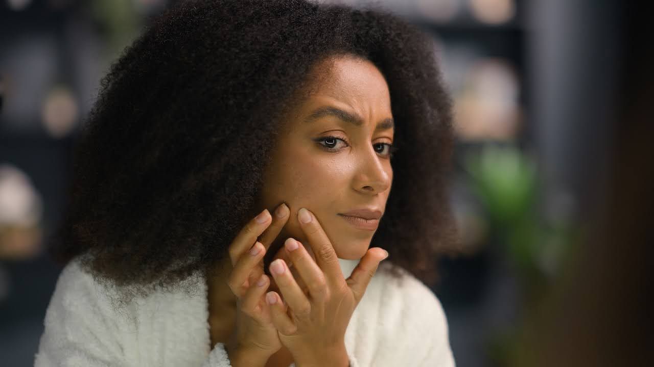 EFFECTIVESOLUTIONSFORADULTACNEINCLIENTS30ANDOLDER